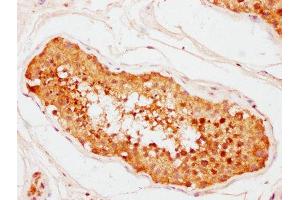 IHC image of ABIN7147093 diluted at 1:400 and staining in paraffin-embedded human testis tissue performed on a Leica BondTM system. (CNOT1 Antikörper  (AA 595-744))