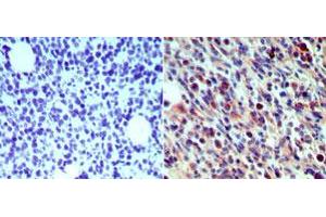 Langerin Immunohistochemistry. (CD207 Antikörper)