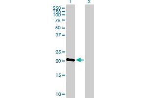 Western Blot analysis of C1orf57 expression in transfected 293T cell line by C1orf57 MaxPab polyclonal antibody. (C1orf57 Antikörper  (AA 1-190))