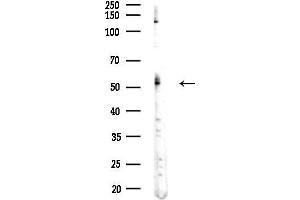 anti-Proteasome (Prosome, Macropain) 26S Subunit, ATPase, 1 (PSMC1) (N-Term) antibody