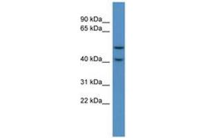 Image no. 1 for anti-Fukutin Related Protein (FKRP) (C-Term) antibody (ABIN6746249) (FKRP Antikörper  (C-Term))