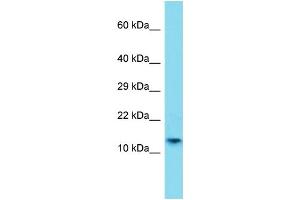 Host: Rabbit Target Name: H2AFB1 Sample Type: A549 Whole Cell lysates Antibody Dilution: 1. (H2AFB1 Antikörper  (N-Term))
