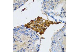 Immunohistochemistry (Paraffin-embedded Sections) (IHC (p)) image for anti-Progesterone Receptor Membrane Component 1 (PGRMC1) (AA 44-195) antibody (ABIN6145520)