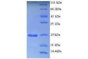 SDS-PAGE (SDS) image for Aldehyde Oxidase 1 (AOX1) (AA 236-421), (PCMH-type domain) protein (His tag) (ABIN5709049)