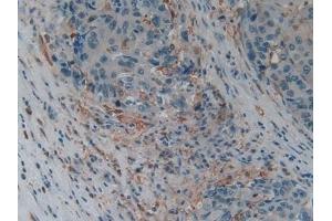 Immunohistochemistry (IHC) image for anti-Gelsolin (GSN) (AA 577-771) antibody (ABIN7442030)