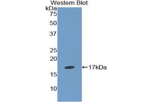 Detection of Recombinant EPN1, Human using Polyclonal Antibody to Epsin 1 (EPN1) (Epsin 1 Antikörper  (AA 279-437))