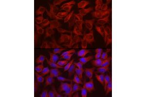 Immunofluorescence analysis of HeLa cells using WISP2 Rabbit pAb (ABIN6128928, ABIN6150226, ABIN6150228 and ABIN6216206) at dilution of 1:100 (40x lens).