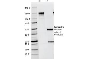 SDS-PAGE Analysis Purified gp100 / Melanosome Mouse Monoclonal Antibody (NKI-beteb). (Melanoma gp100 Antikörper)