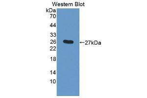 Western blot analysis of the recombinant protein. (Cathepsin F Antikörper  (AA 249-462))
