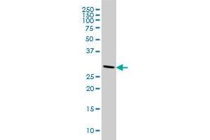 CNOT7 monoclonal antibody (M01), clone 2F6 Western Blot analysis of CNOT7 expression in HeLa . (CNOT7 Antikörper  (AA 1-285))