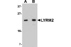 Western Blotting (WB) image for anti-LYR Motif Containing 2 (LYRM2) (C-Term) antibody (ABIN1030499) (LYRM2 Antikörper  (C-Term))
