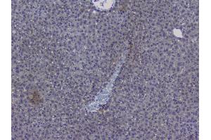 IHC analysis of NRF1 using anti-NRF1 antibody (ABIN6719347). (NRF1 Antikörper  (AA 246-503))