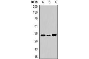 Western blot analysis of WDR5 expression in 22RV1 (A), BT474 (B), Hela (C) whole cell lysates. (WDR5 Antikörper)