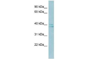RAD51AP1 antibody used at 1 ug/ml to detect target protein. (RAD51AP1 Antikörper  (Middle Region))