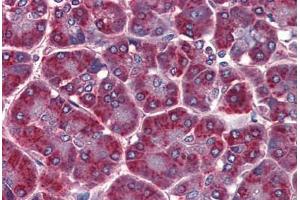 Human Pancreas: Formalin-Fixed, Paraffin-Embedded (FFPE) (ALDH3A1 Antikörper  (C-Term))