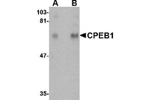 Western Blotting (WB) image for anti-Cytoplasmic Polyadenylation Element Binding Protein 1 (CPEB1) (N-Term) antibody (ABIN1031326) (CPEB1 Antikörper  (N-Term))