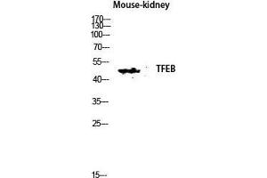 Western Blot (WB) analysis of Mouse Kidney lysis using TFEB antibody. (TFEB Antikörper  (N-Term))