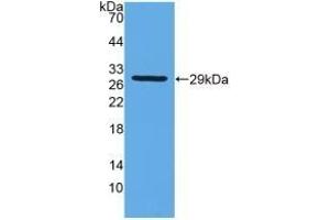GSTT2 Antikörper  (AA 16-242)