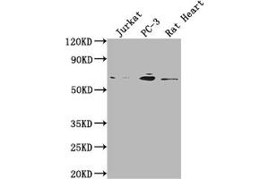 Western Blot Positive WB detected in: Jurkat whole cell lysate, PC-3 whole cell lysate, Rat Heart tissue All lanes: E2F1 antibody at 1:2000 Secondary Goat polyclonal to rabbit IgG at 1/50000 dilution Predicted band size: 47 kDa Observed band size: 60 kDa (Rekombinanter E2F1 Antikörper)