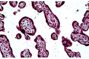 Human Placenta: Formalin-Fixed, Paraffin-Embedded (FFPE) (SH3KBP1 Antikörper  (AA 2-14))