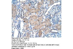 Rabbit Anti-SLA/LP Antibody  Paraffin Embedded Tissue: Human Kidney Cellular Data: Epithelial cells of renal tubule Antibody Concentration: 4.
