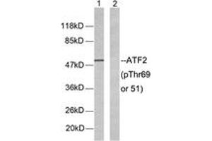 Western blot analysis of extracts from LOVO cells, using ATF2 (Phospho-Thr69 or 51) Antibody.