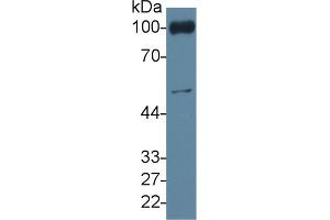 Rabbit Capture antibody from the kit in WB with Positive Control: Mouse blood cells lysate.