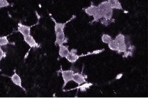 Immunofluorescence staining of PC12 cells (Rat neuroblastoma, ATCC CRL-1721). (PKC alpha Antikörper  (AA 270-427))