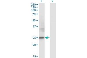 Western Blot analysis of FNDC4 expression in transfected 293T cell line by FNDC4 monoclonal antibody (M01), clone 7F9.