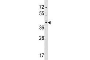SOX7 antibody western blot analysis in HepG2 lysate. (SOX7 Antikörper  (AA 310-339))