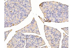 ABIN7094803 and ABIN7098854 at 1/100 staining Rat stomach tissue by IHC-P. (Asporin Antikörper  (C-Term))