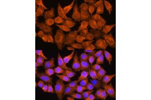 Immunofluorescence analysis of HeLa cells using  Rabbit pAb (ABIN1678678, ABIN3017841, ABIN3017842 and ABIN6220287) at dilution of 1:100. (AOX1 Antikörper  (AA 340-590))