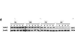 Identification of RUNX1 as an apoptosis transcription factor and an independent prognostic factor in NB tissue and cell lines. (RUNX1 Antikörper  (AA 221-480))