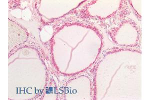 ABIN6391411 (5µg/ml) staining of paraffin embedded Human Thyroid. (Notch1 Antikörper  (AA 171-182))