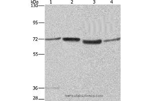 Western blot analysis of A375 and 231 cell, 293T cell and human hepatocellular carcinoma tissue , using SYN1 Polyclonal Antibody at dilution of 1:550 (SYN1 Antikörper)