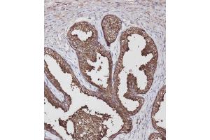 Immunohistochemical analysis of C on paraffin-embedded Human prostate tissue was performed on the Leica®BOND RXm. (LGALS3BP Antikörper  (AA 383-412))