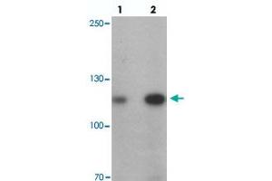 Western blot analysis of ANKRD27 in K-562 cell lysate with ANKRD27 polyclonal antibody  at (lane 1) 1 and (lane 2) 2 ug/mL. (ANKRD27 Antikörper  (N-Term))