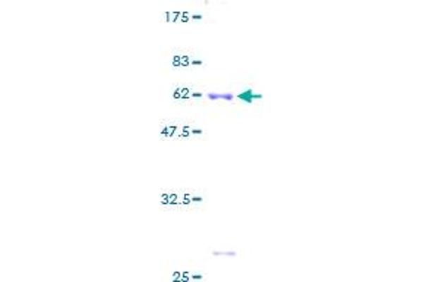 RPS6 Protein (AA 1-249) (GST tag)