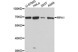 Western blot analysis of extracts of various cell lines, using RPA1 antibody.