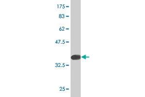 Western Blot detection against Immunogen (37. (NDUFS4 Antikörper  (AA 66-175))