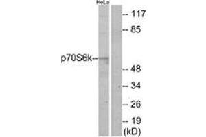 Western blot analysis of extracts from HeLa cells, using p70 S6 Kinase (Ab-424) Antibody. (RPS6KB1 Antikörper  (AA 414-463))