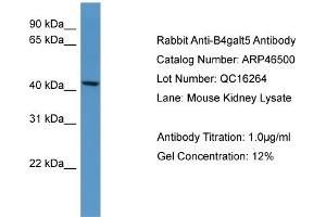 Western Blotting (WB) image for anti-UDP-Gal:betaGlcNAc beta 1,4- Galactosyltransferase, Polypeptide 5 (B4GALT5) (C-Term) antibody (ABIN2773883)