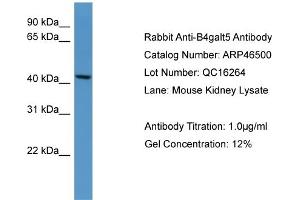 WB Suggested Anti-B4galt5 Antibody Titration:  0. (B4GALT5 Antikörper  (C-Term))
