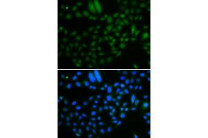 Immunofluorescence analysis of A549 cells using ALKBH8 antibody (ABIN5974297). (ALKBH8 Antikörper)