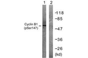 Western blot analysis of extracts from Jurkat cells treated with UV 15', using Cyclin B1 (Phospho-Ser147) Antibody. (Cyclin B1 Antikörper  (pSer147))