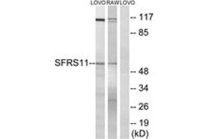 Western blot analysis of extracts from LOVO/RAW264. (SRSF11 Antikörper  (AA 211-260))