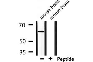 Western Blotting (WB) image for anti-Ceramide Kinase-Like (CERKL) (Internal Region) antibody (ABIN6260772)