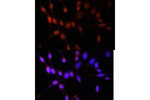 Immunofluorescence analysis of NIH/3T3 cells using KA antibody (ABIN7268768) at dilution of 1:100. (MYST3 Antikörper  (AA 800-1000))