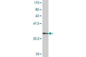 Western Blot detection against Immunogen (35.