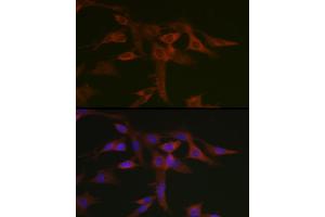 Immunofluorescence analysis of C6 cells using STA Rabbit pAb (ABIN6128540, ABIN6148576, ABIN6148578 and ABIN6223670) at dilution of 1:50 (40x lens). (STAT5A Antikörper  (AA 635-794))